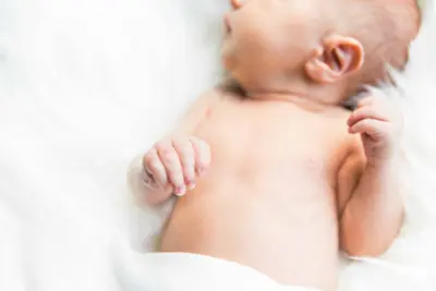 what is colic